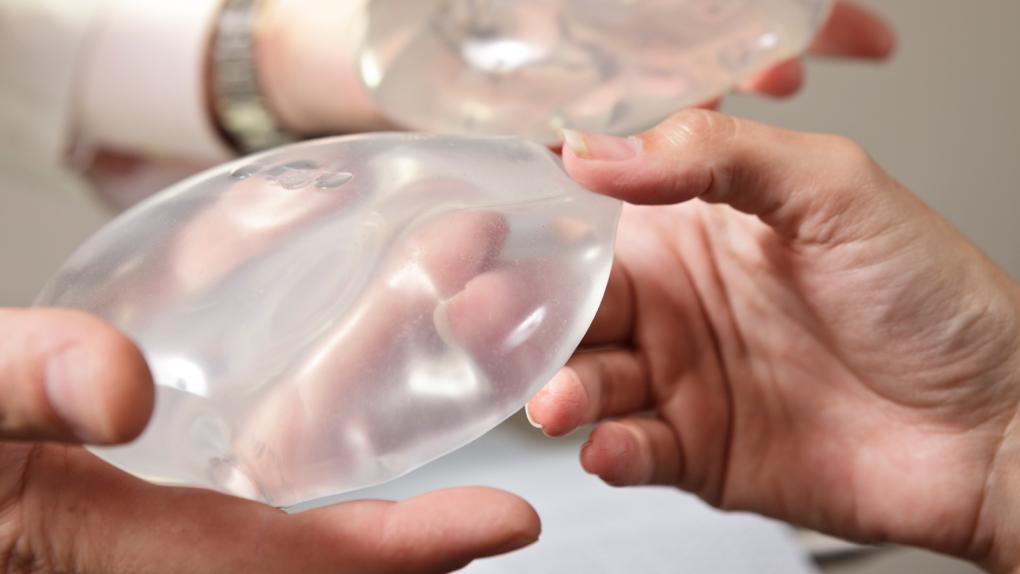 breast-implants-comparison-1600x900_0.jpg