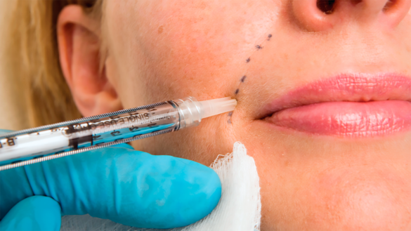 Injectable Dermal Fillers