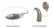Neuro Cochlear Implant System
