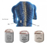 Senza Spinal Cord Stimulation (SCS) System