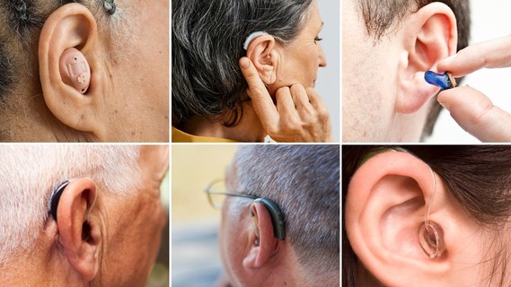 Photographs of various hearing aids.