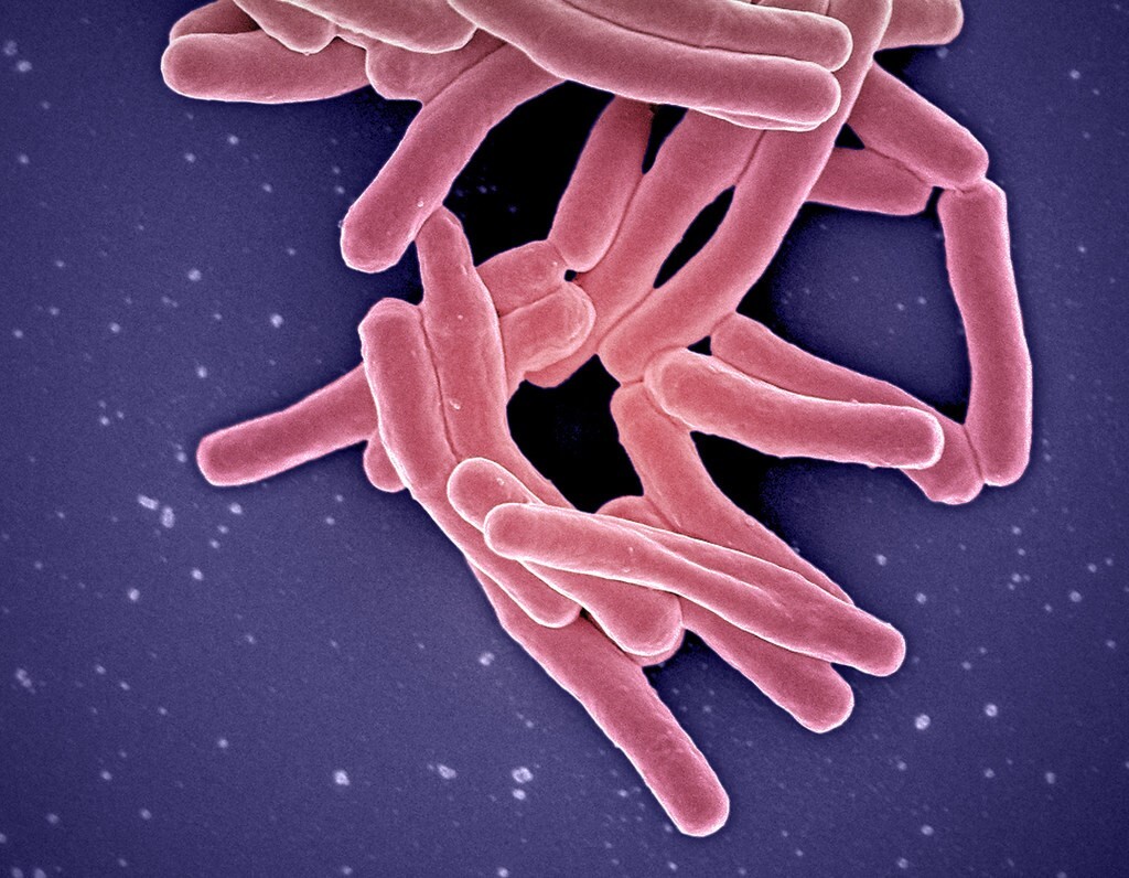 Mycobacterium tuberculosis bacteria.