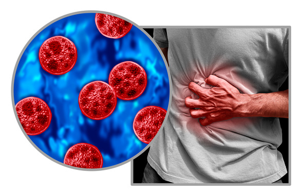 Cyclospora and Your Food: What You Should Know