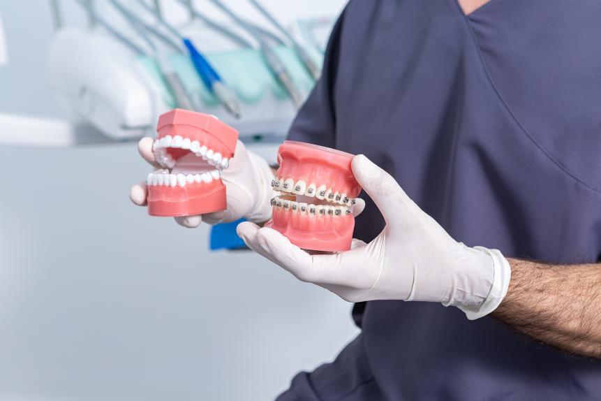 Braces Image