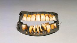 denture