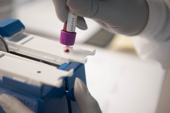 Photo of a gloved hand transferring a blood sample from a collection tube to a slide for testing