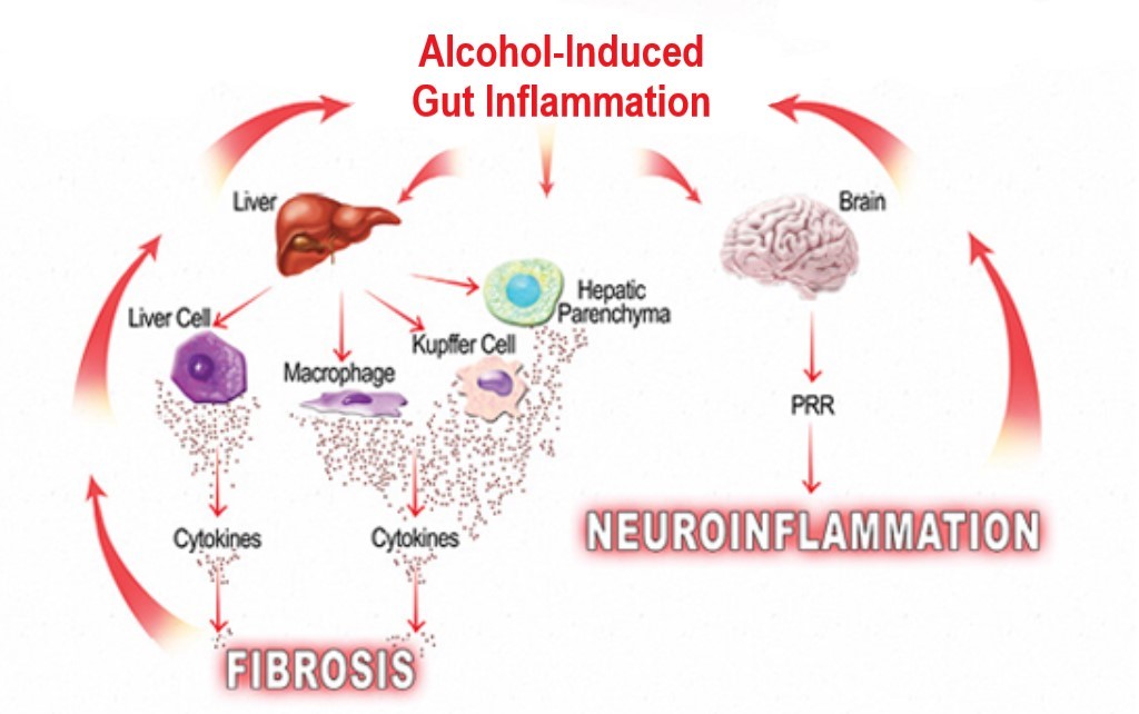 alcohol-induced gut inflammation