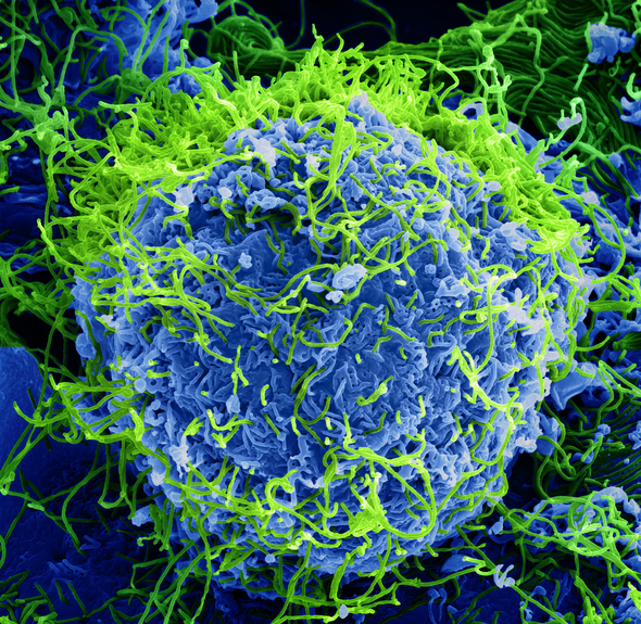 Ebola virus particles