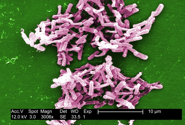 Digitally-colorized scanning electron microscopic (SEM) image depicts a large grouping of rod-shaped, Gram-positive Clostridium difficile bacteria.