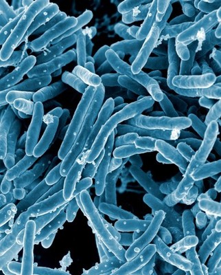 Mycobacterium tuberculosis