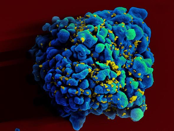 HIV-infected T cell