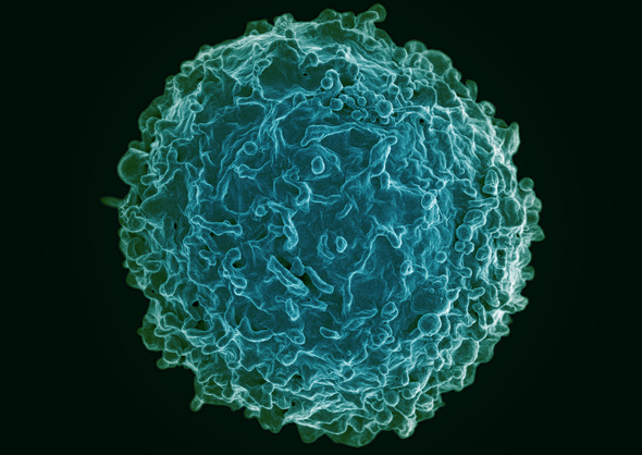 Scanning electron micrograph of a B cell