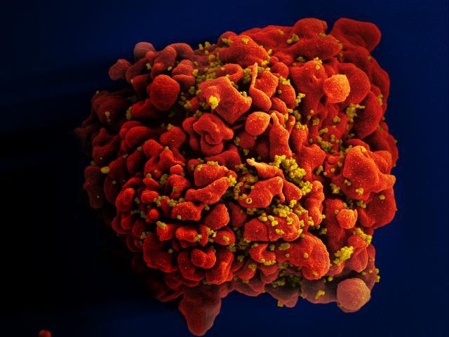 HIV-infected T cell