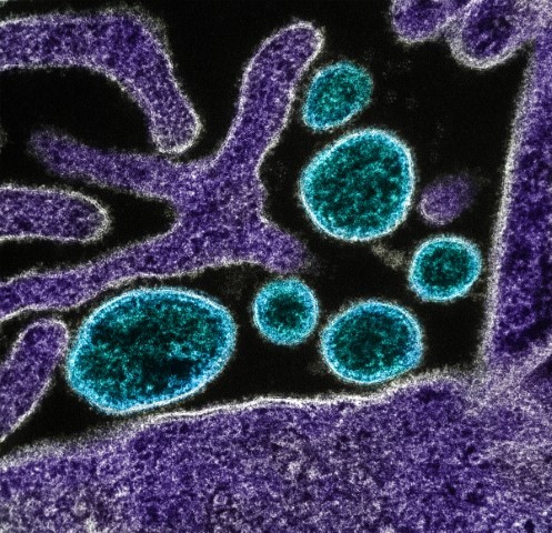 Nipah virus particles