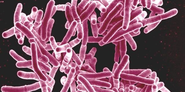 micrograph of Mycobacterium tuberculosis