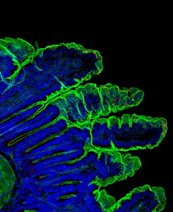 cryptosporidium parasites in mouse small intestine