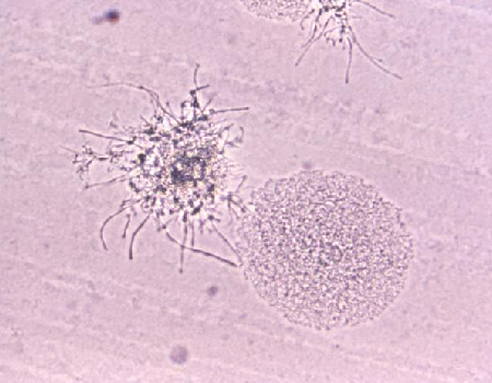 Fosfomycin