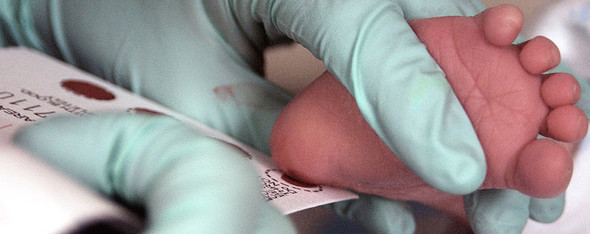 Blood being collected by heel stick for newborn screening