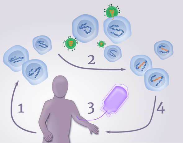 Overview of the X-SCID gene therapy developed by NIAID and St. Jude scientists