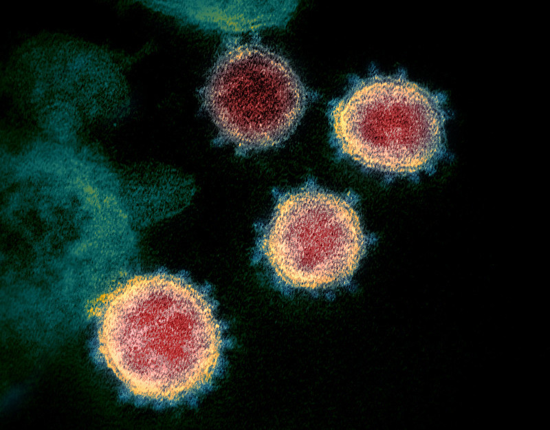 microscope image shows SARS-CoV-2—also known as 2019-nCoV, the virus that causes COVID-19