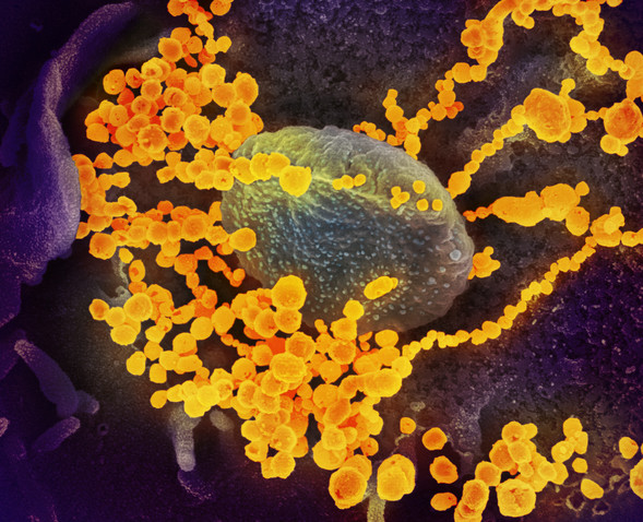 Scanning electron microscope image shows SARS-CoV-2 (round gold objects) emerging from the surface of cells cultured in the lab. Credit: NIAID-RML