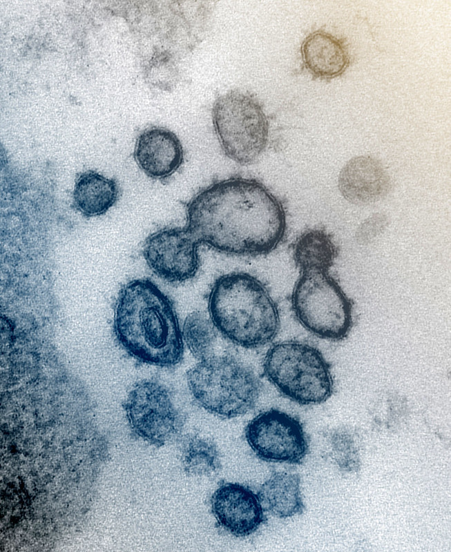 novel coronavirus