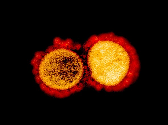 Transmission electron micrograph of SARS-CoV-2 virus particles, isolated from a patient. Credit: NIAID