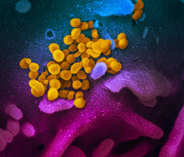 This scanning electron microscope image shows SARS-CoV-2 (yellow) emerging from the surface of cells (blue/pink) cultured in the lab. Credit: NIAID