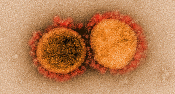 SARS-CoV-2 virus particles