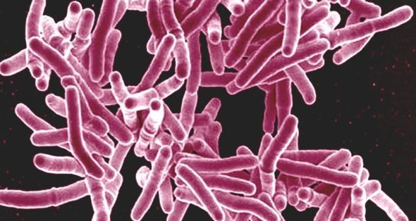 Mycobacterium tuberculosis, the bacterium that causes TB