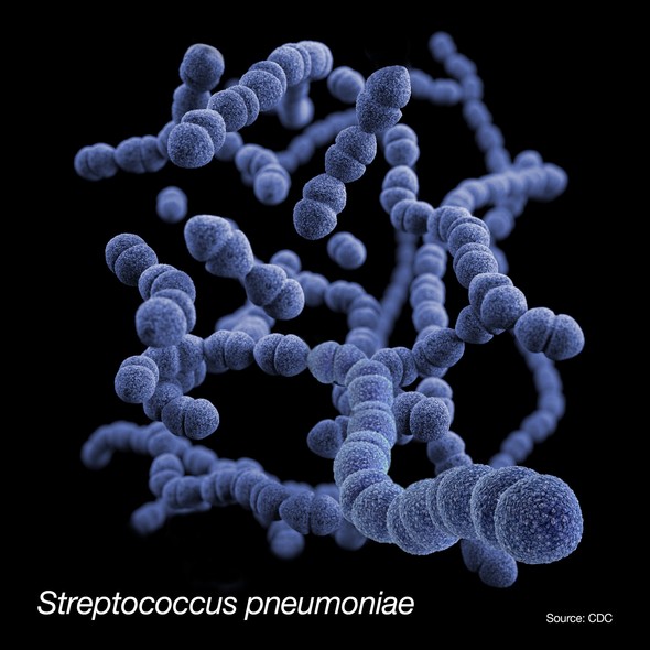 s. pneumonia