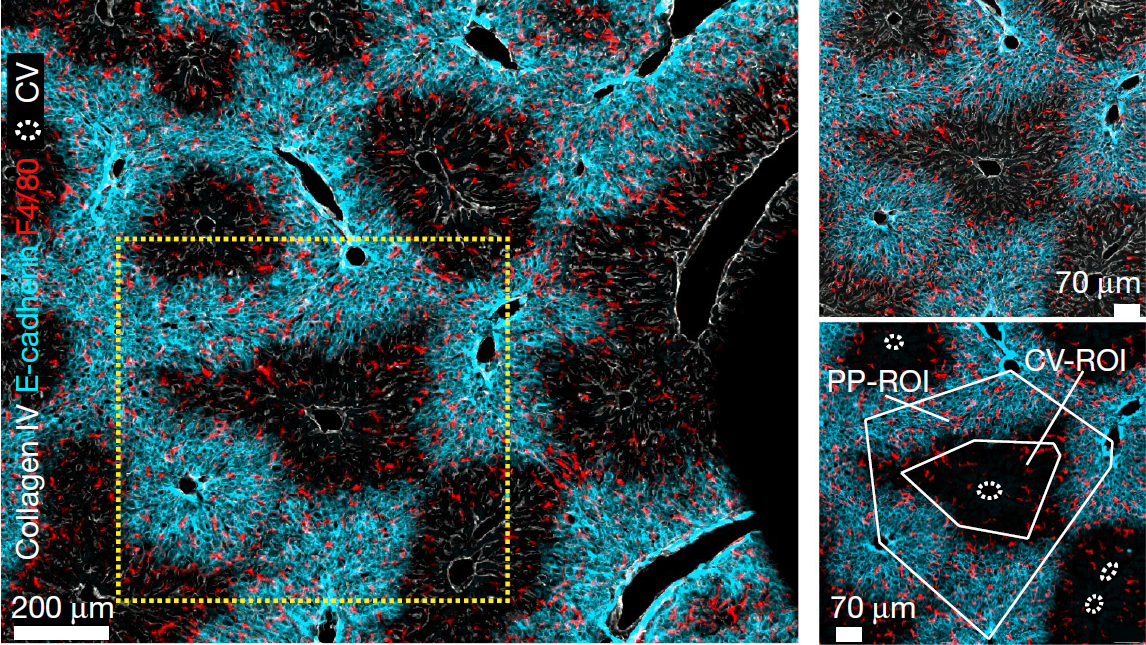 Immunofluorescence images showing distribution of immune cells in liver cells surrounding the portal vein and endothelial cells. 