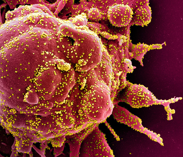 SARS-CoV-2 particles emerging from cell