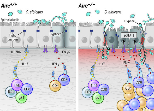 Diagram of immune responses in healthy tissues compared to tissues with AIRE deficiency