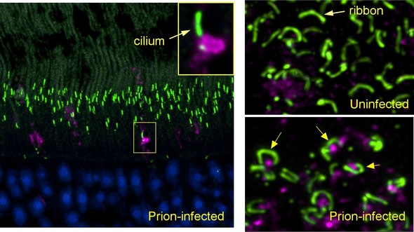 Prion eye