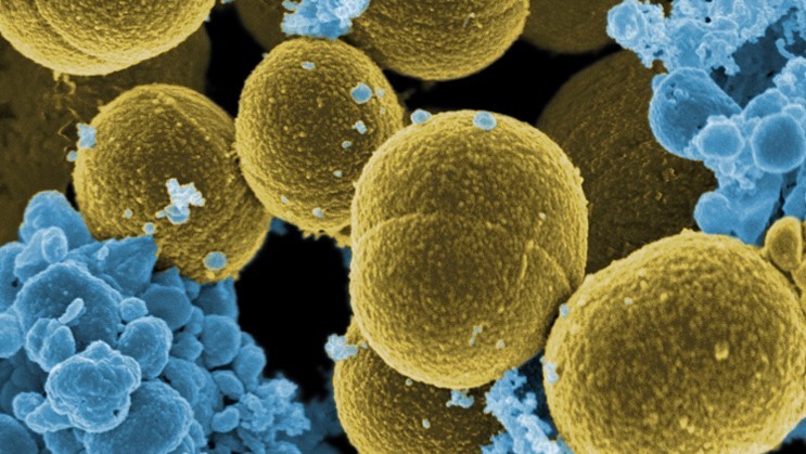 Staphylococcus aureus bacteria