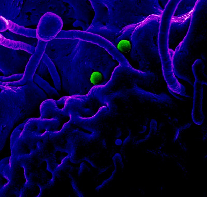 MERS coronavirus