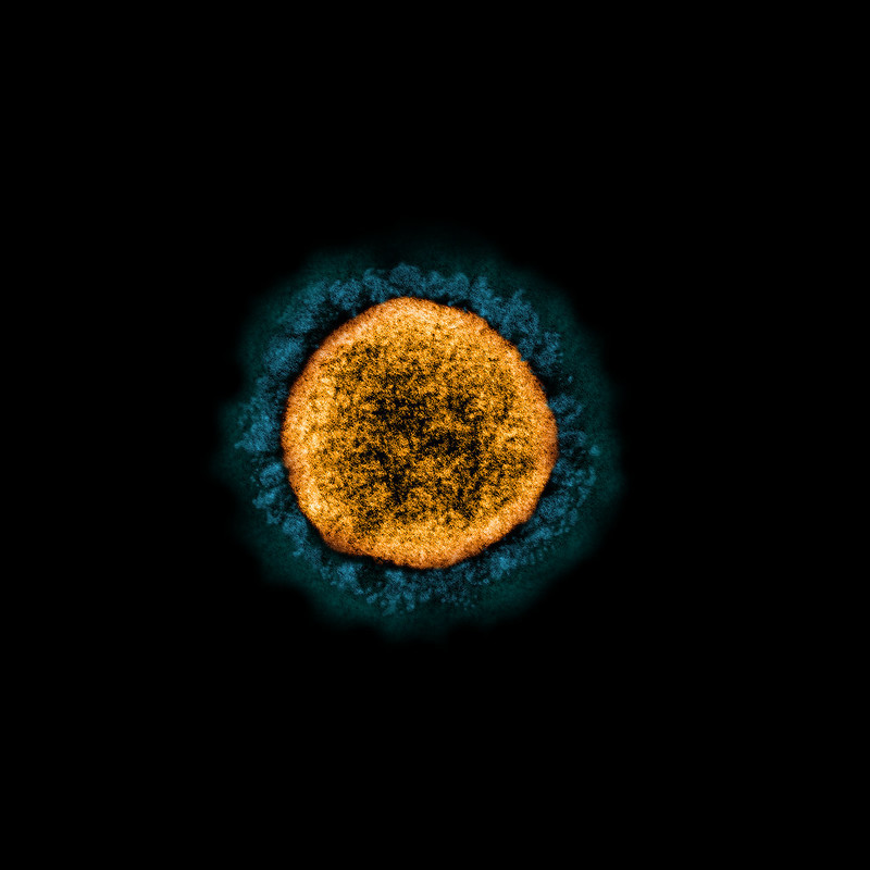 SARS-CoV-2 virus particle