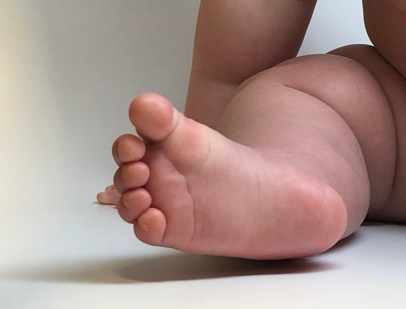 Photo of a baby's leg and foot