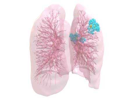 3D visualization of lungs