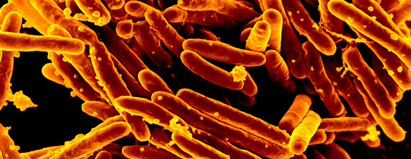 Scanning electron micrograph of Mycobacterium tuberculosis, the bacterium that causes TB