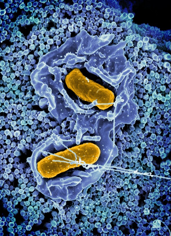 Scanning electron micrograph of Salmonella Typhimurium invading a human epithelial cell.