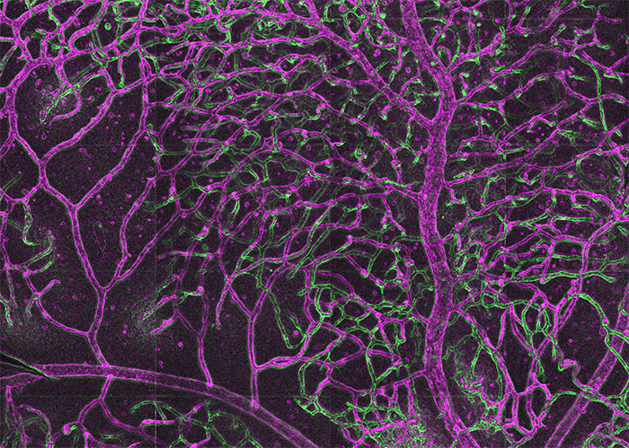 Image of retinal blood vessels