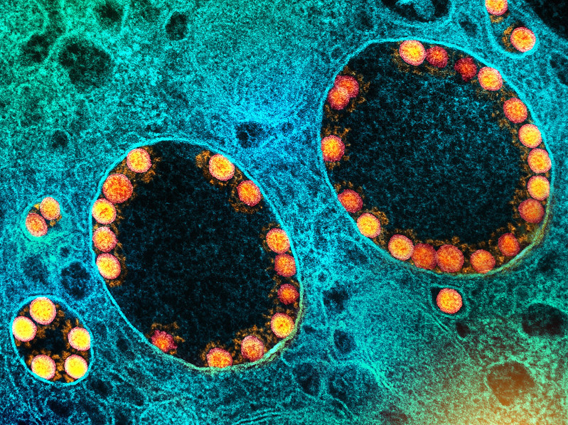 sarscov2 virus in nasal cells