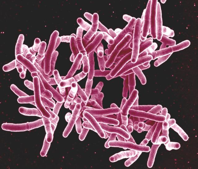 Mycobacterium tuberculosis bacteria