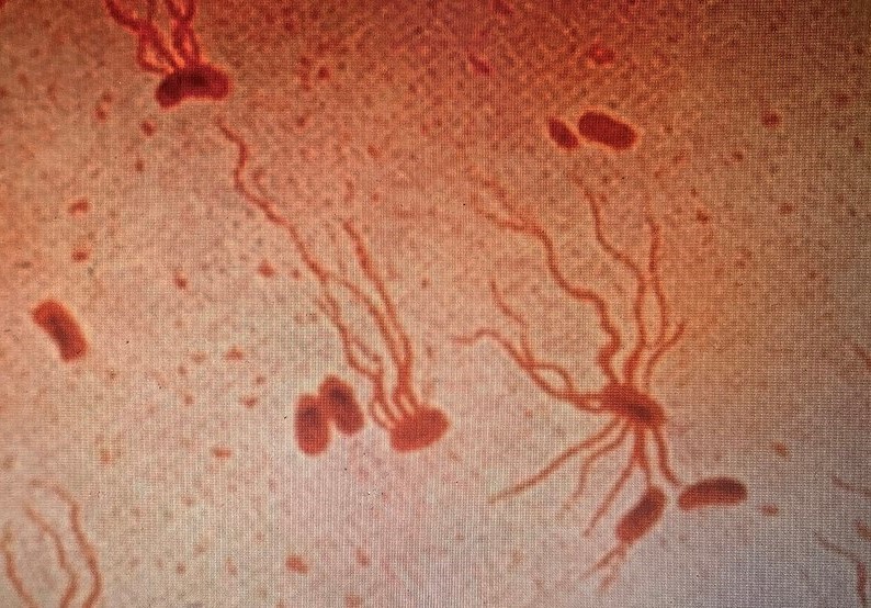 Bacteria that cause typhoid fever shown under a microscope with red flagellar stain