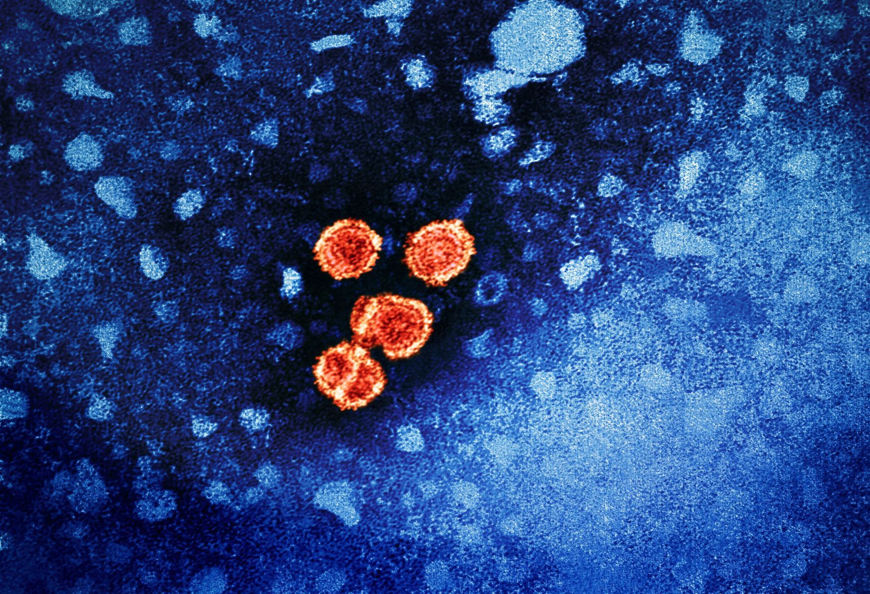 Hepatitis B virus 