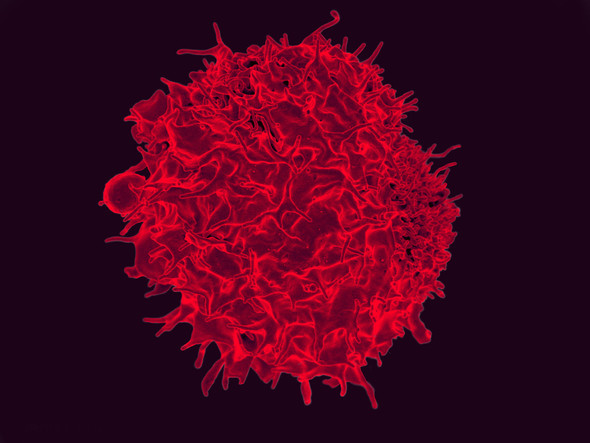 colorized scanning  electron micrograph of T lymphocyte