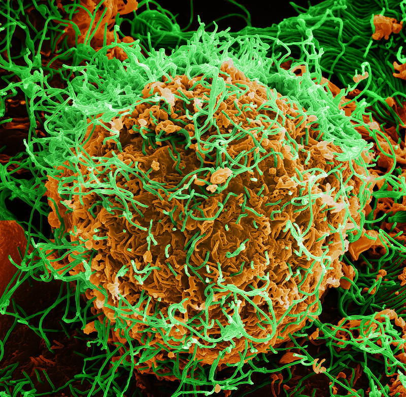 Ebola virus particles on a cell