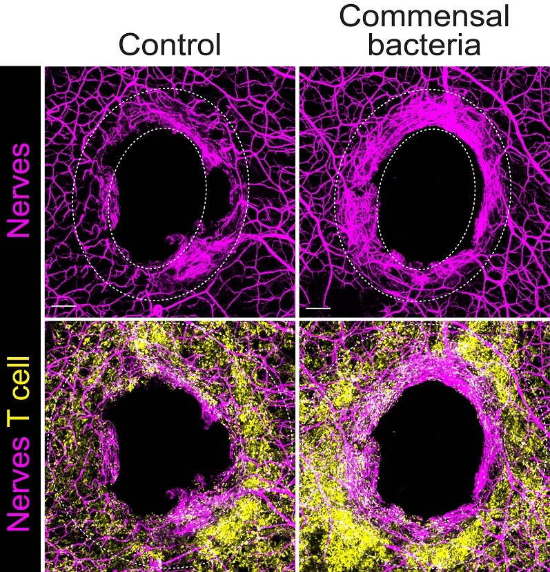 bacteria nerve repair